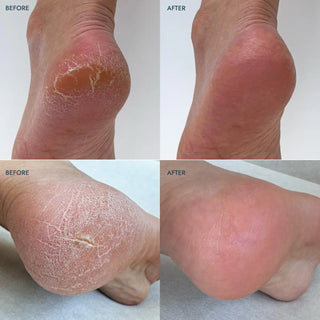 Heel Repair Duo - barndoorboutiquetn